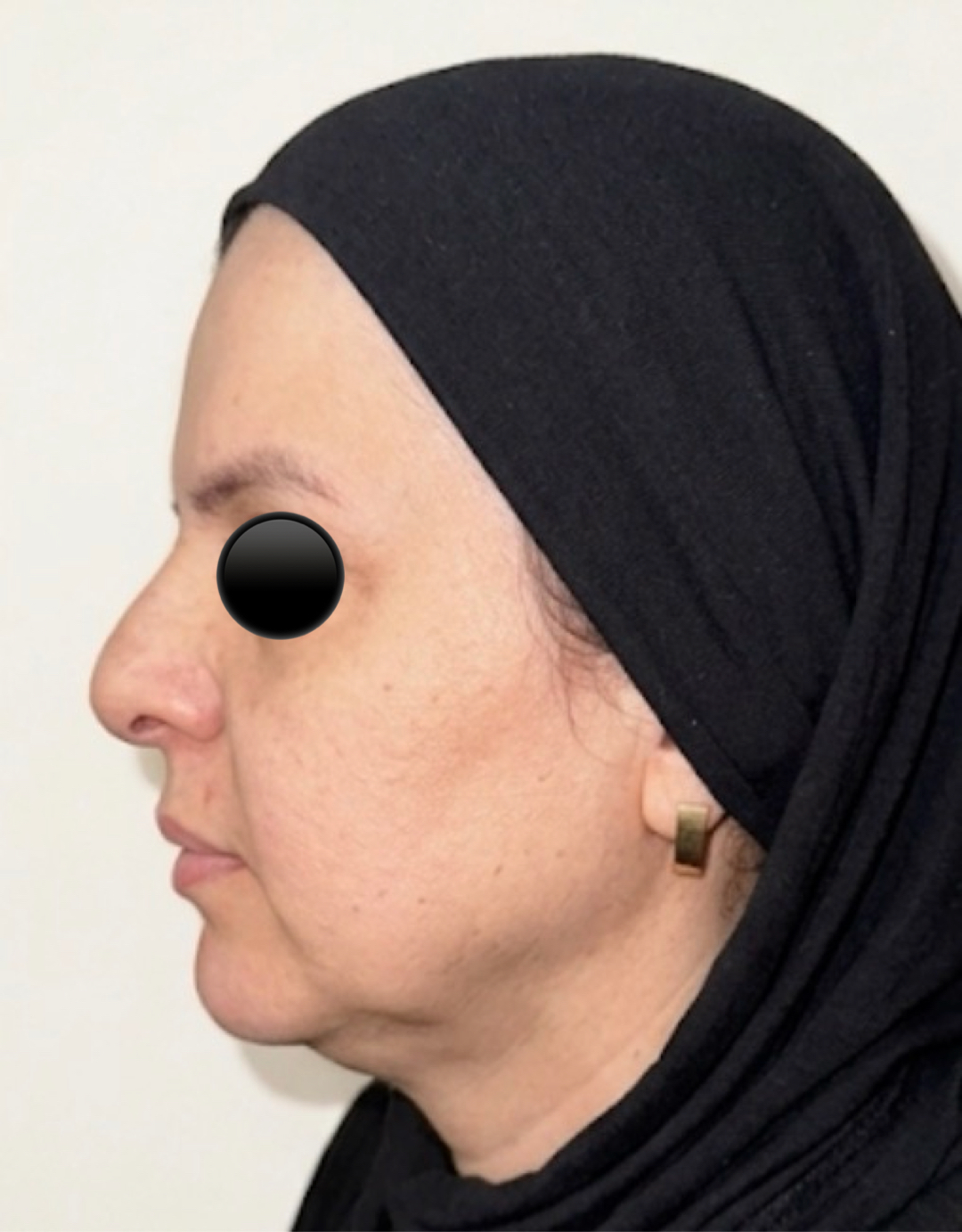 شد الوجه و الرقبة